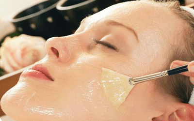 Peeling pores dilatés