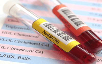 Quelle différence entre cholestérol HDL et LDL