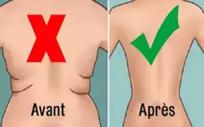 Comment perdre de la graisse du dos 10 aliments - Vie Femme D'or